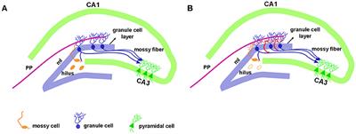 Is Mossy Fiber Sprouting a Potential Therapeutic Target for Epilepsy?